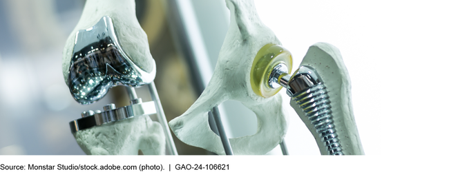 Example of Knee and Hip Replacement Implantable Medical Devices