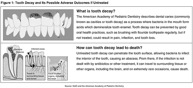 Figure 1: Tooth Decay and Its Possible Adverse Outcomes if Untreated 