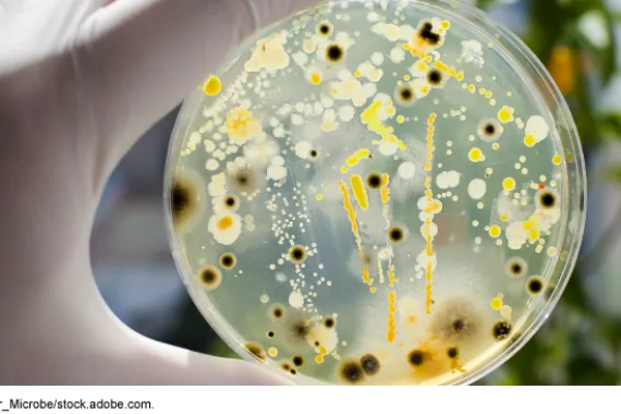 A gloved hand holding a petri dish with bacteria and mold.